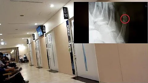 Broken Bone in a Japanese Hospital - DayDayNews