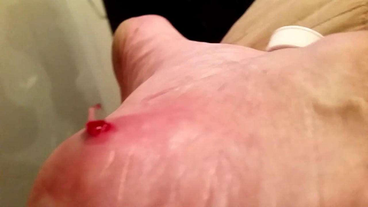 1 Piece Of Glass In My Heel See It Get Pulled Out Video Comes Into Focus After A Few Seconds Youtube