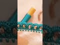 ضرس بالكروشي والعقيق