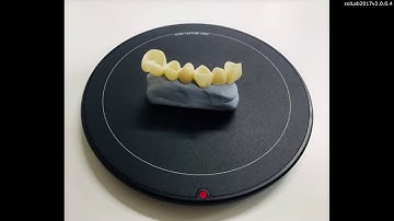 25 Scanning the bottom surface of a wax-up