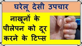 नाख़ून के पीलेपन को दूर करने के आसान टिप्स | Gharelu Desi Upchar screenshot 1