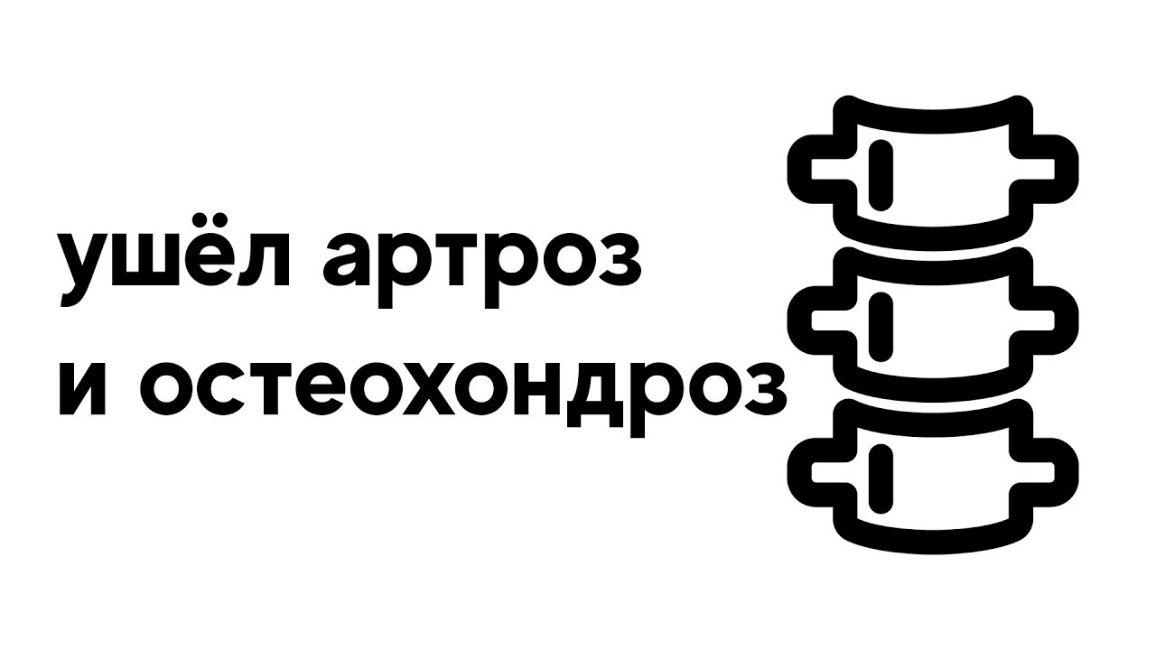 Ушел артроз и остеохондроз. Колени и спина не болят - YouTube
