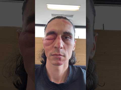 J’AI EU UN ACCIDENT…?