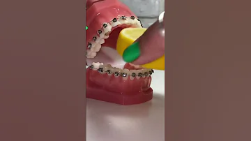شكل الي مركب تقويم كيف ياكل صح ام خطأ 