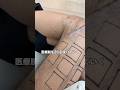 医療脱毛1回目の結果はコレ！ #医療脱毛 #検証 #剛毛