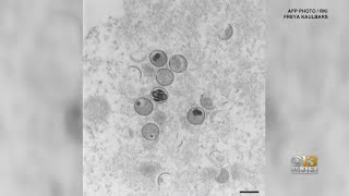 U.S. declares monkeypox outbreak a public health emergency
