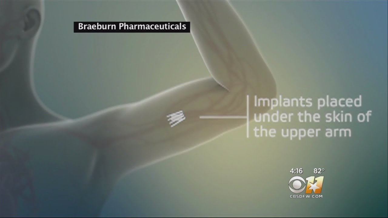 Implant Helps Drug Addicts Kick