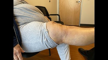 1 Week Follow Up after Outpatient Robotic Knee Replacement... (Great Outcome, Small Scar)