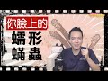 ◉DR. KO玩美研究室 - 柯威志醫師◉ 什麼？！我的臉上有蟲？