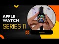 Apple Watch Series 11 Full Review | Huge Upgrade or Just Hype?
