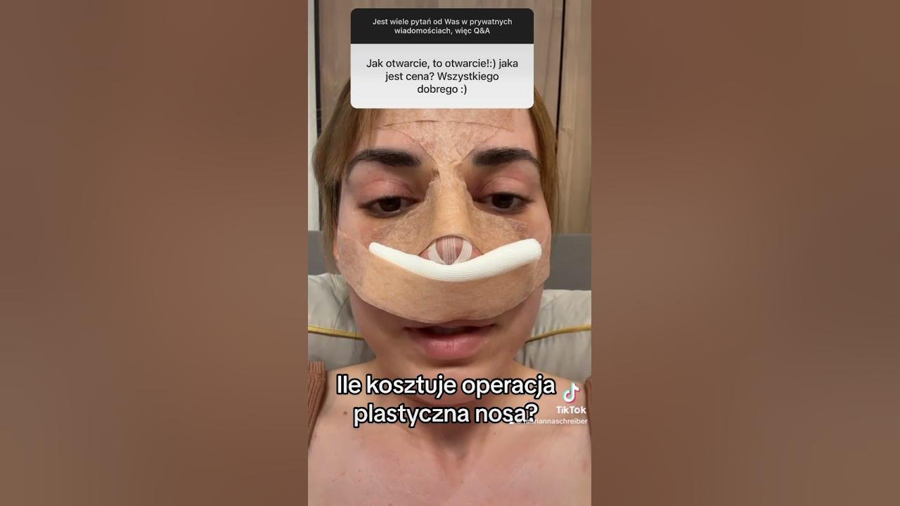 Ile Kosztuje Wątroba Na Czarnym Rynku Ile kosztuje operacja plastyczna nosa? #operacjaplastyczna #