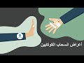 ماذا يحدث لك بعد الإقلاع عن تناول الكوكايين 