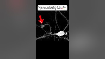 Brain cell restructures itself after forming a new connection #neuroplasticity #neuroscience #brain