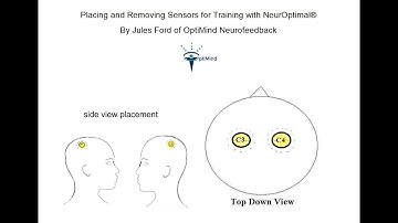 Applying and Removing Sensors for Training with NeurOptimal®.