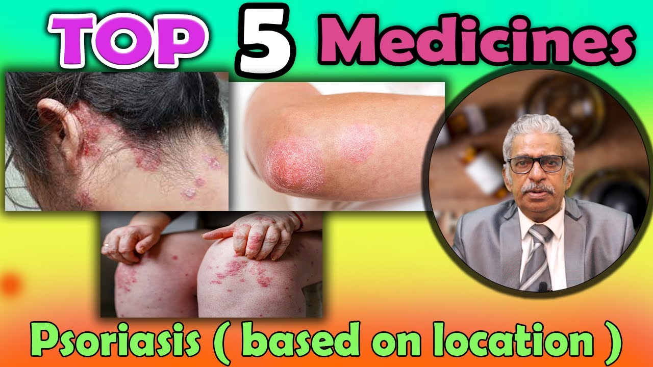 Top 5 - Homeopathy Medicines for Psoriasis (Based on Location)