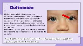Síndrome del ojo de gato Síndrome del ojo de gato