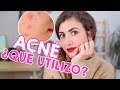 ¿Qué Utilizo para ELIMINAR el ACNÉ? 😜| Lo que Mejor Me Ha Funcionado