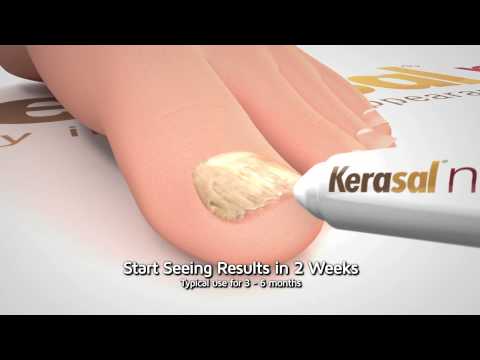 Kerasal Nail: Restore Healthy Nail Appearance (10 Sec)