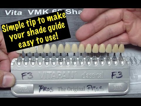 Tooth Shade Conversion Chart