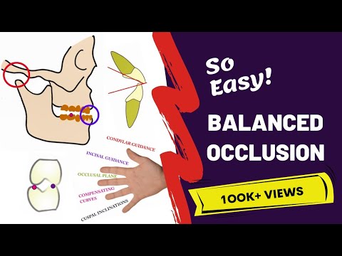 Balanced Occlusion Made
