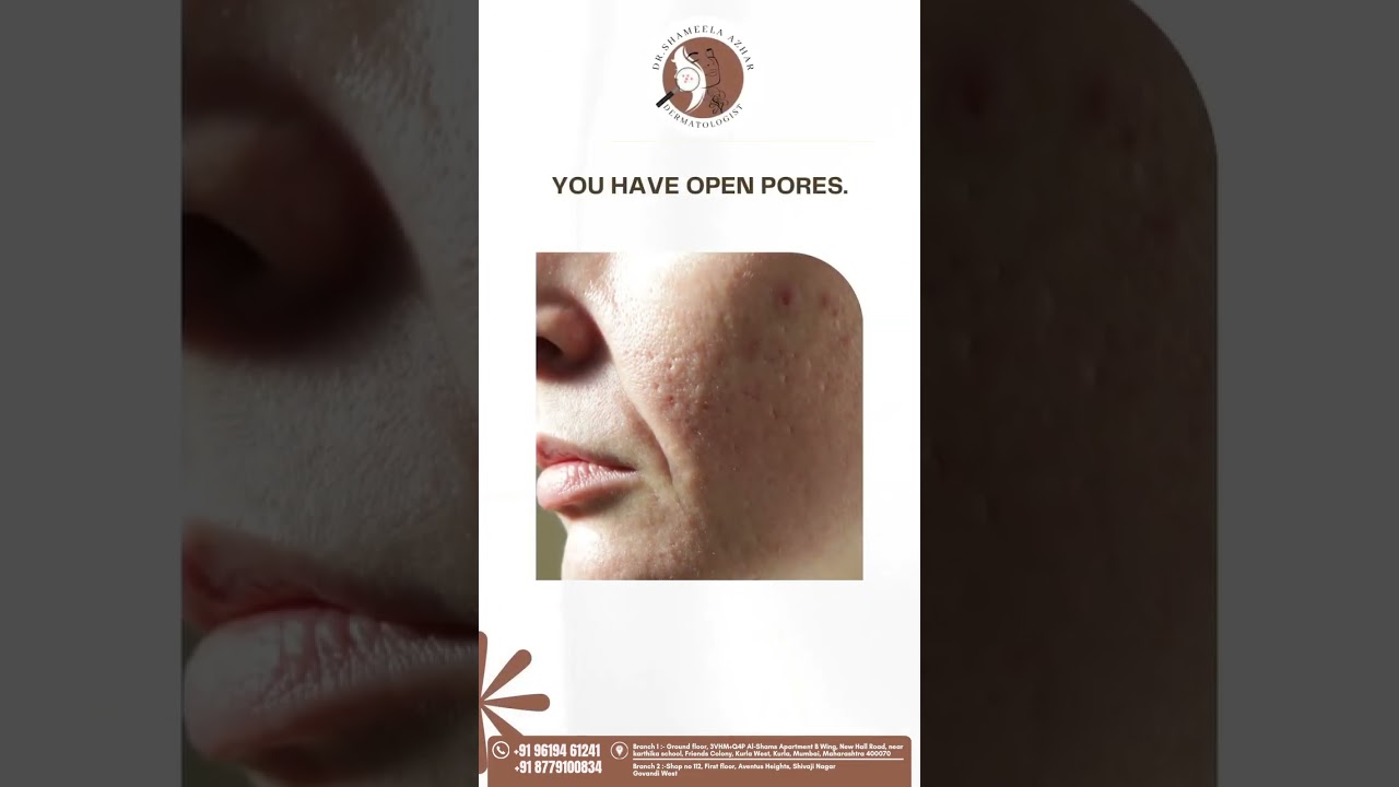 Healthy skin isn’t about filters, it’s about care 