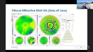 Webinar Carones