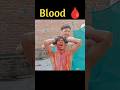 WWE India 🇮🇳 Blood Match | Roman Reigns vs John Cena #shorts #viralshorts