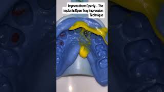 Impress them openly 💃The implants Open Tray Impression Technique #dentist #dentalprosthesis #smile