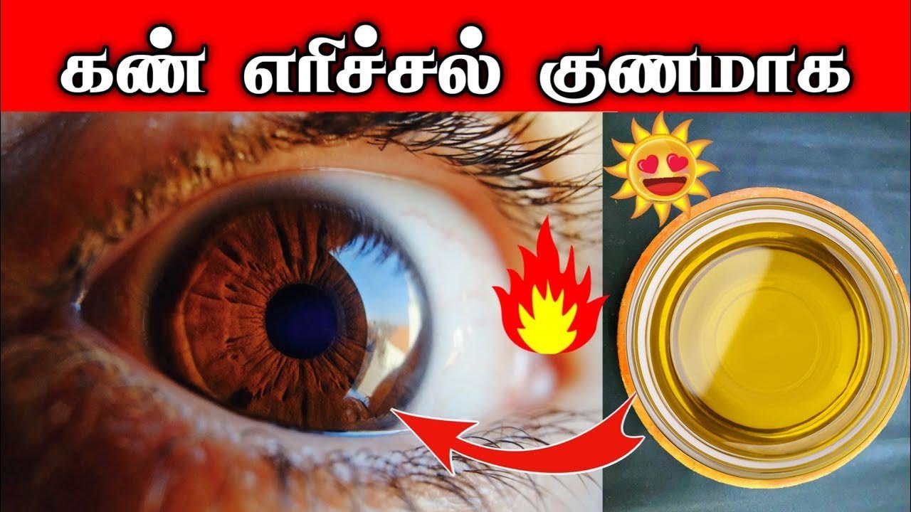 கண் எரிச்சல் குணமாக How to cure eye irritation in tamil Dr