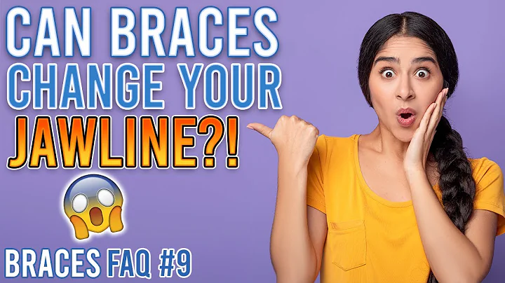 Can braces change your jawline? (2023)