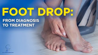 How to Fix Foot Drop Fast: Causes, Symptoms & Best Treatments!