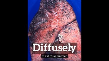 What is Diffusely? | How Does Diffusely Look? | How to Say Diffusely in English?