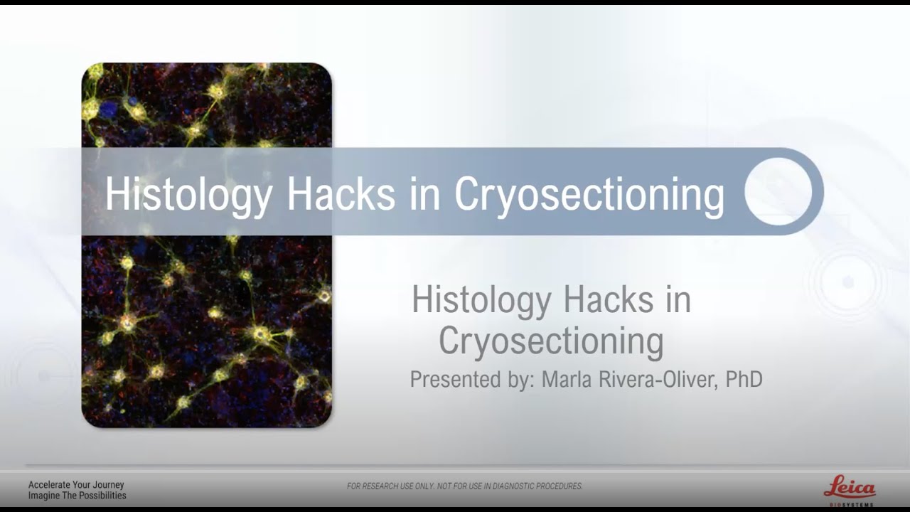 HISTOLOGY HACKS FOR CRYOSECTIONING