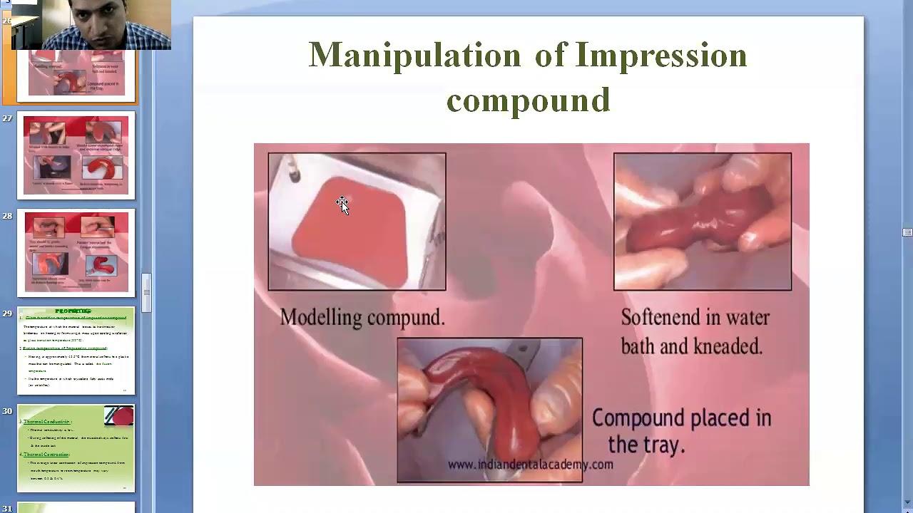 Impression Materials in Prosthodontics part 2 YouTube