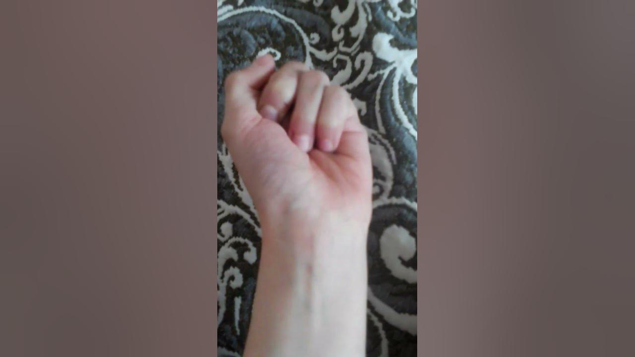 мне рил палец отрезали - YouTube