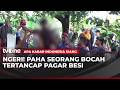 NAHAS! Paha Bocah di Bone Tertusuk Pagar Besi | AKIS tvOne