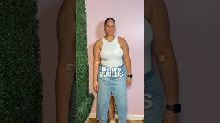 10 Months After Gastric Balloon -56 Lbs