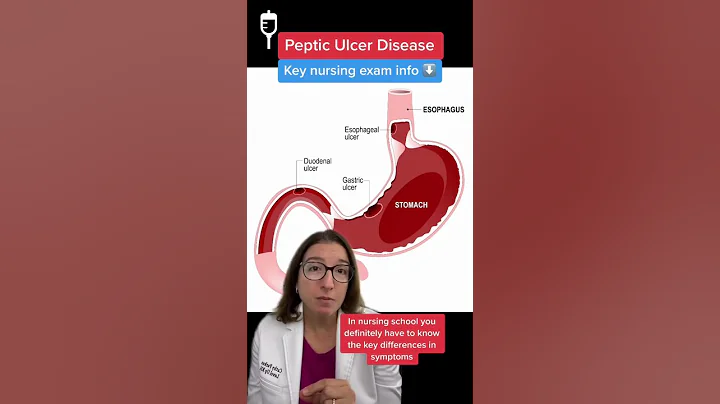 Peptic Ulcers: Medical Surgical SHORT | @LevelUpRN