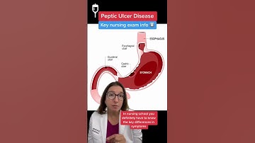 Peptic Ulcers: Medical Surgical SHORT | @LevelUpRN