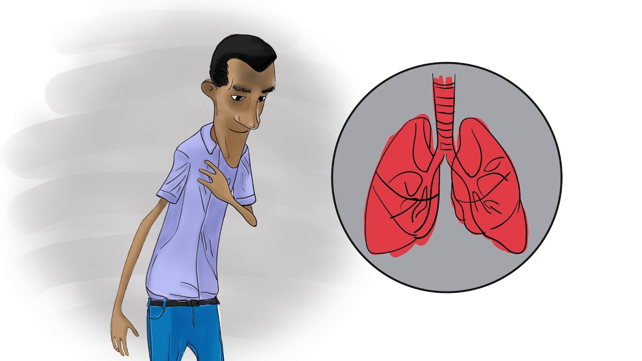 Toma correcta do tratamento antiretroviral