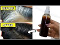 with only 3 ingredients, remove your gray hair permanently and naturally