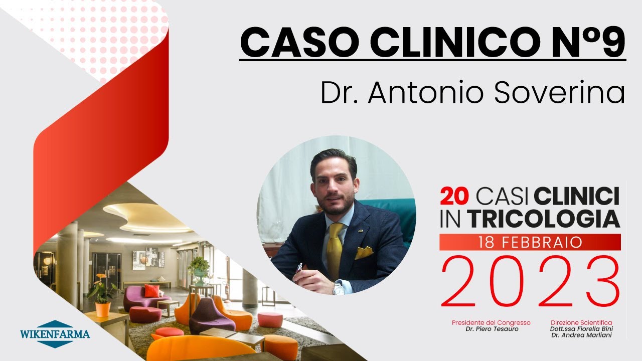 Dott. Antonio Soverina: fibrosing alopecia in a pattern distribution