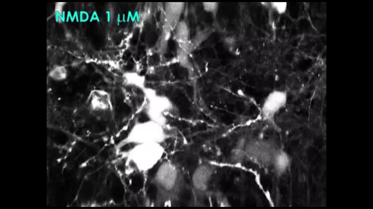 Cortical neurons NMDA