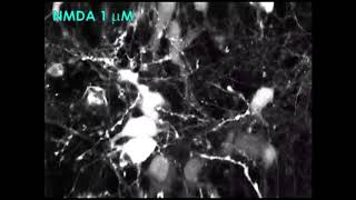 Cortical neurons NMDA