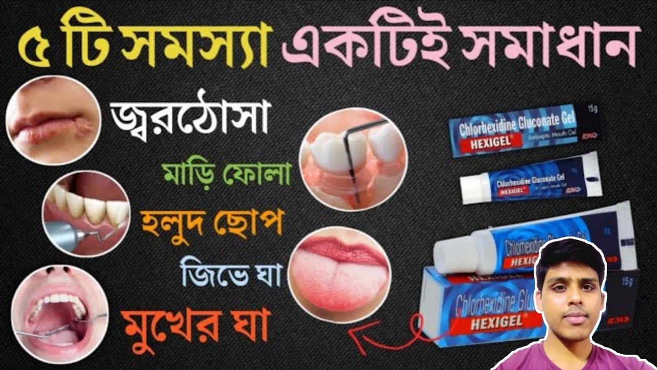 Hexigel Review | দাঁতের ৫ টি সমস্যার দ্রুত সমাধান করে | ব্যবহারকারীরা কোন কোন সর্তকতা অবলম্বন করবেন?