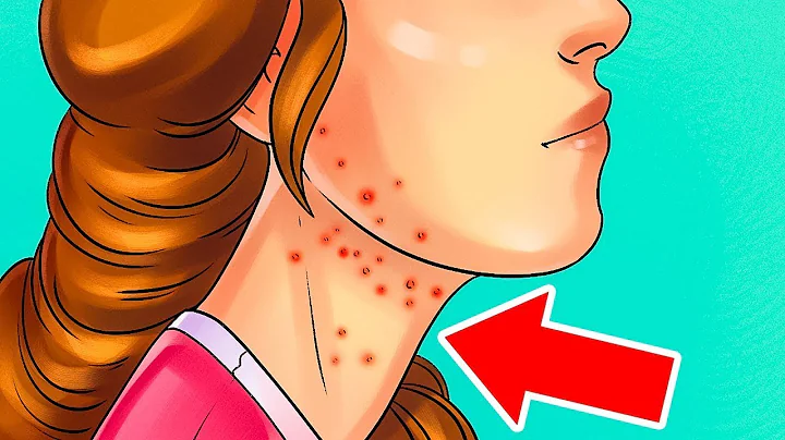 5 signs your body shows when you are eating too much protein