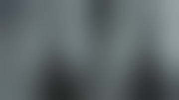 Anterolateral approach to mid shaft of humerus fracture