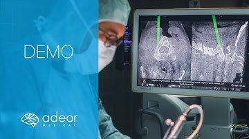 adeor x Brainlab - Navigated High Speed Drilling