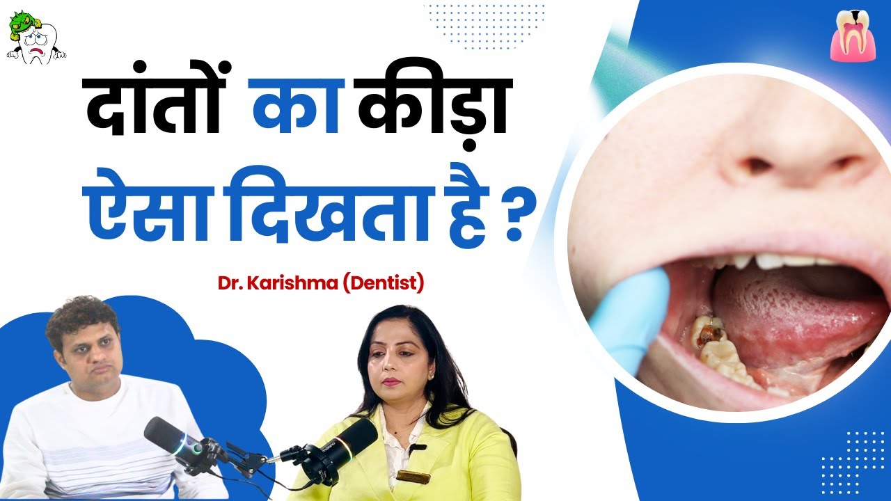 दांतों में कीड़ा लगने से बचने के उपाय Dr. Karishma Pyria Treatment
