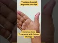 Common Cold Treatment With Colour Therapy #sujok #acupressure